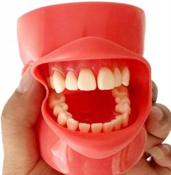 Dental Implant Teeth Model - Dental Oral Simulation Simple Head Mold Tooth Extraction Practice Model Medical Teaching Education Aid.